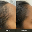 ESCOVA DE TRATAMENTO ANTI-QUEDA