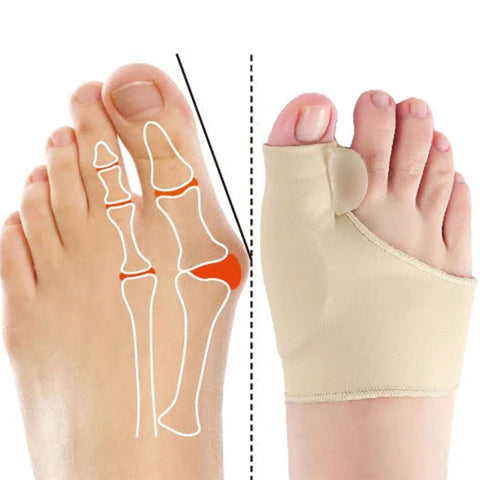 Corretor de Joanetes AlinhaFlex - COMPRE 1 E LEVE 2!